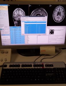 brain picture neuroscience lab