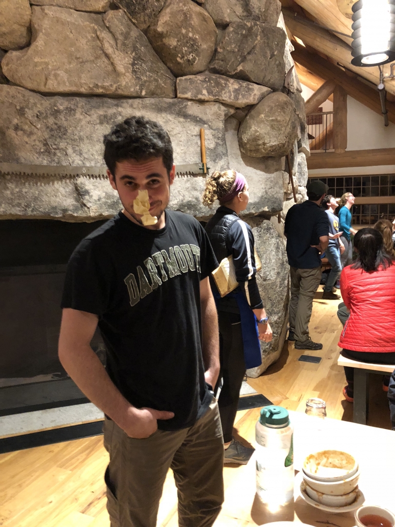 Julian with a lot of tape on his nose